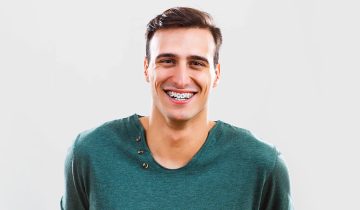 What Procedures Are Considered Orthodontic?