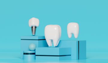 The Benefits of Dental Implants: Why They’re a Permanent Solution