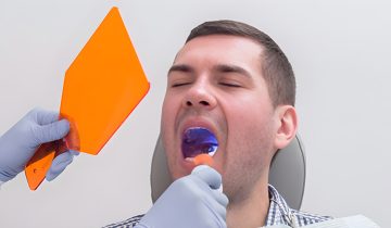 Avoid Dry Socket After Tooth Extraction for Faster Healing