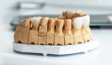 The Step-by-Step Process of Getting Dental Veneers